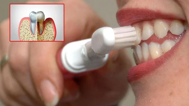 agiz bakterileri kalp krizine yol acabilir OfWMszSx