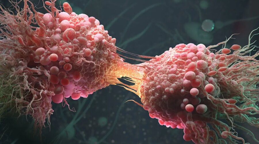 kanser kelimesi eskisi gibi son anlamina gelmiyor basari orani 2 kat artti 4X8VS6QL